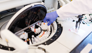 Ein wisseschaftlicger Mitarbeiter des UMG-Labors entfernt eine Probe aus einem Analysegerät
